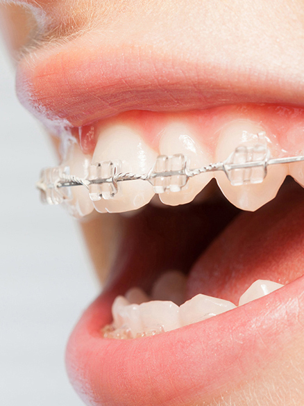 鹿児島市・鹿児島の矯正歯科