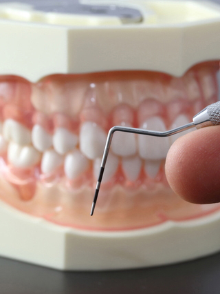 鹿児島市・鹿児島のなるべく神経を残す治療