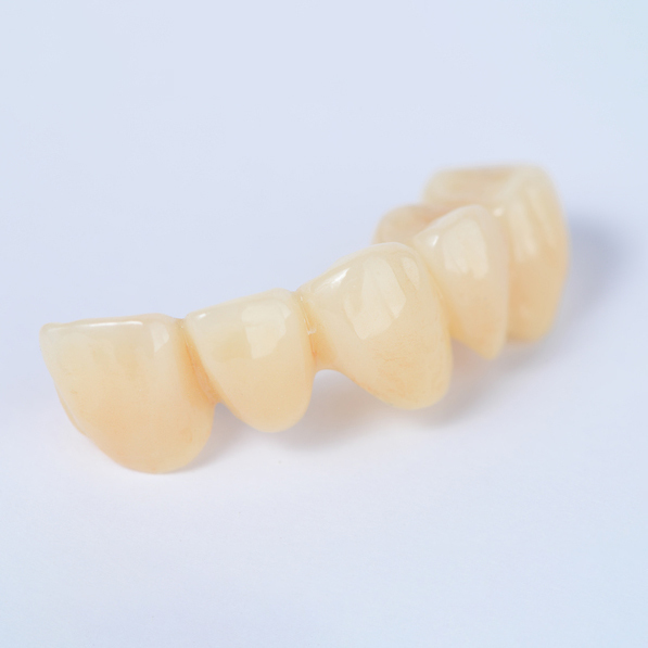 鹿児島市・鹿児島のメタルフリー治療