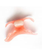 鹿児島市・鹿児島のノンクラスプデンチャー