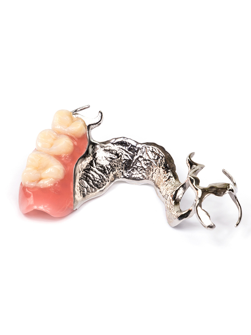 鹿児島市・鹿児島の自費の入れ歯治療