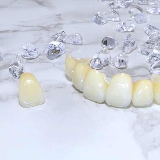 鹿児島市・鹿児島のメタルフリー治療