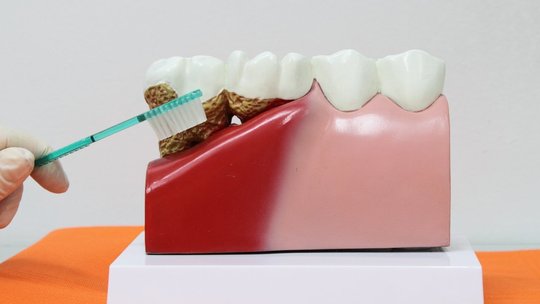 鹿児島市・鹿児島の口臭について