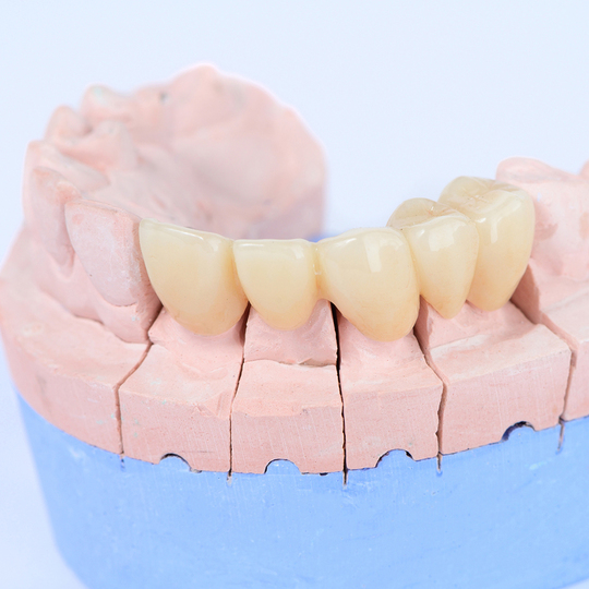 鹿児島市・鹿児島のメタルフリー治療