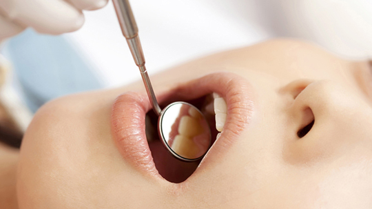 鹿児島市・鹿児島の自費の入れ歯・義歯治療