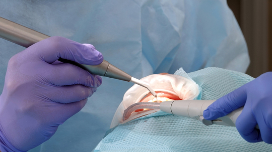 鹿児島市・鹿児島の炭酸ガスレーザー