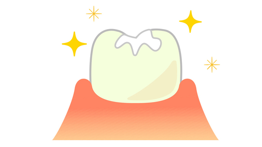 鹿児島市・鹿児島の予防歯科・定期検診