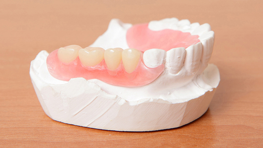 鹿児島市・鹿児島のノンクラスプデンチャー（目立たない部分入れ歯）