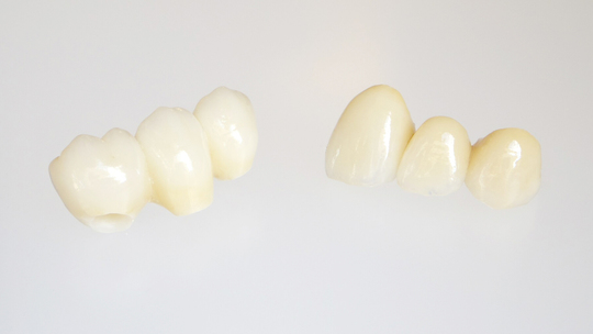 鹿児島市・鹿児島のメタルフリー治療