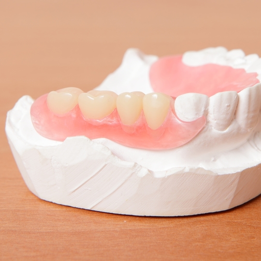 鹿児島市・鹿児島の自費の入れ歯・義歯治療