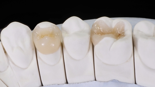 鹿児島市・鹿児島のデジタルスキャナーについて