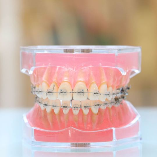 鹿児島市・鹿児島の矯正歯科治療