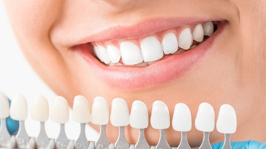 鹿児島市・鹿児島のホワイトニング