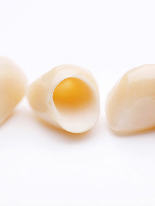 鹿児島市・鹿児島の審美歯科（白い詰め物・被せ物）