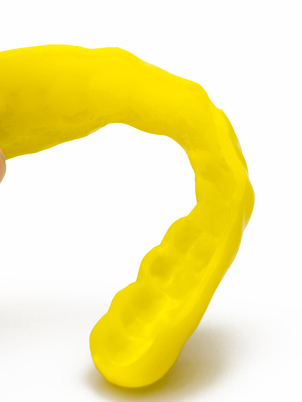 鹿児島市・鹿児島の歯ぎしりの治療（ナイトガード）