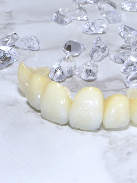 鹿児島市・鹿児島のセラミック治療