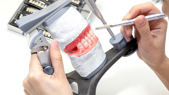 鹿児島市・鹿児島の自費の入れ歯・義歯治療