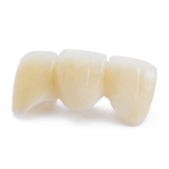 鹿児島市・鹿児島のメタルフリー治療