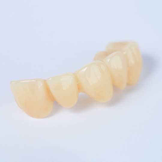 鹿児島市・鹿児島のメタルフリー治療