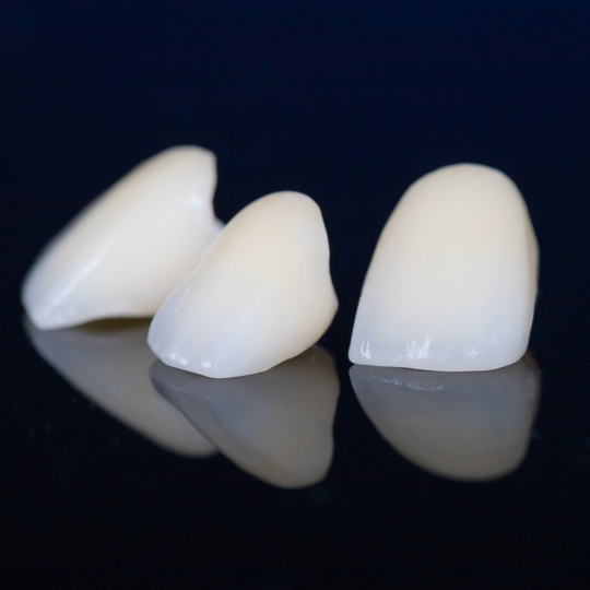 鹿児島市・鹿児島のセラミック治療