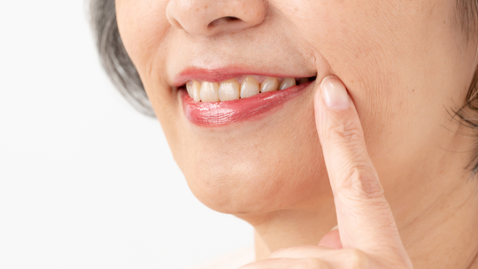 鹿児島市・鹿児島のノンクラスプデンチャー（目立たない部分入れ歯）