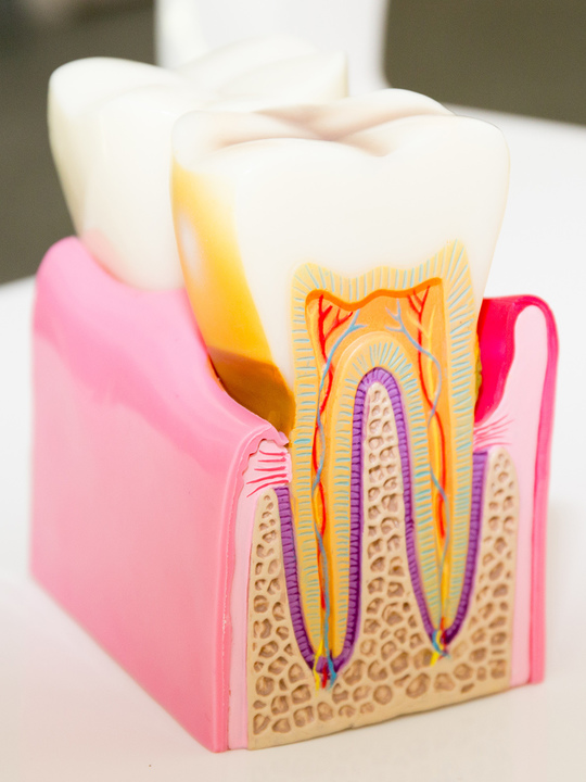 鹿児島市・鹿児島の 歯周病の治療