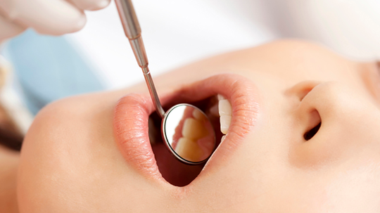 鹿児島市・鹿児島の歯ぎしりの治療（ナイトガード）