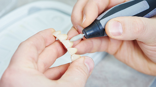 鹿児島市・鹿児島の審美歯科治療（白い詰め物・被せ物）