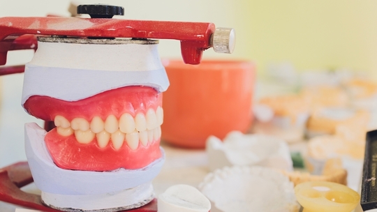 鹿児島市・鹿児島の自費の入れ歯・義歯治療