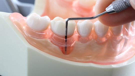 鹿児島市・鹿児島の口臭について