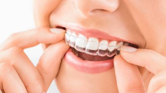 鹿児島市・鹿児島の矯正歯科治療