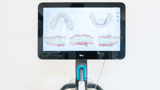 鹿児島市・鹿児島のデジタルスキャナーについて