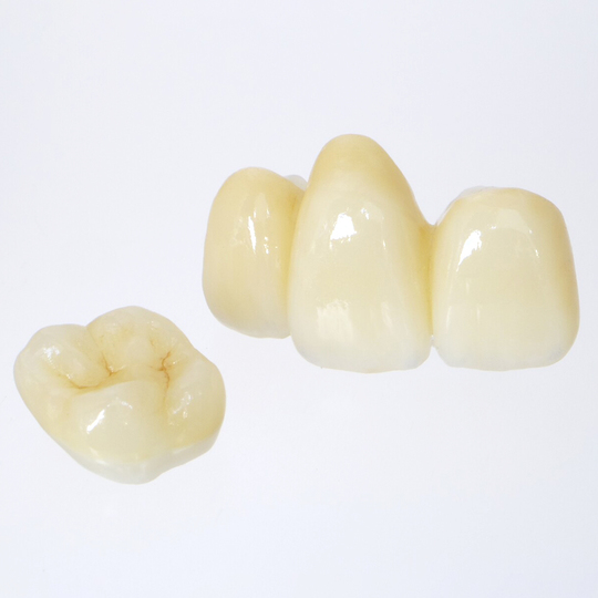 鹿児島市・鹿児島のセラミック治療