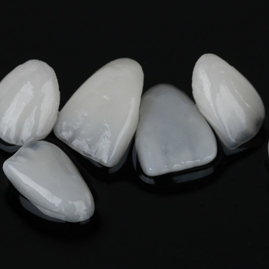 鹿児島市・鹿児島の審美歯科治療（白い詰め物・被せ物）